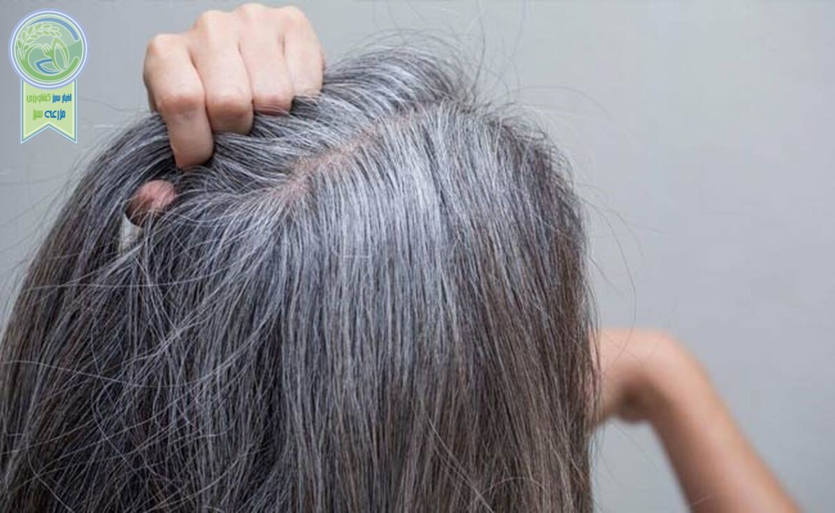 جلوگیری از سفید شدن موی سر با مصرف این ویتامین‌ها

