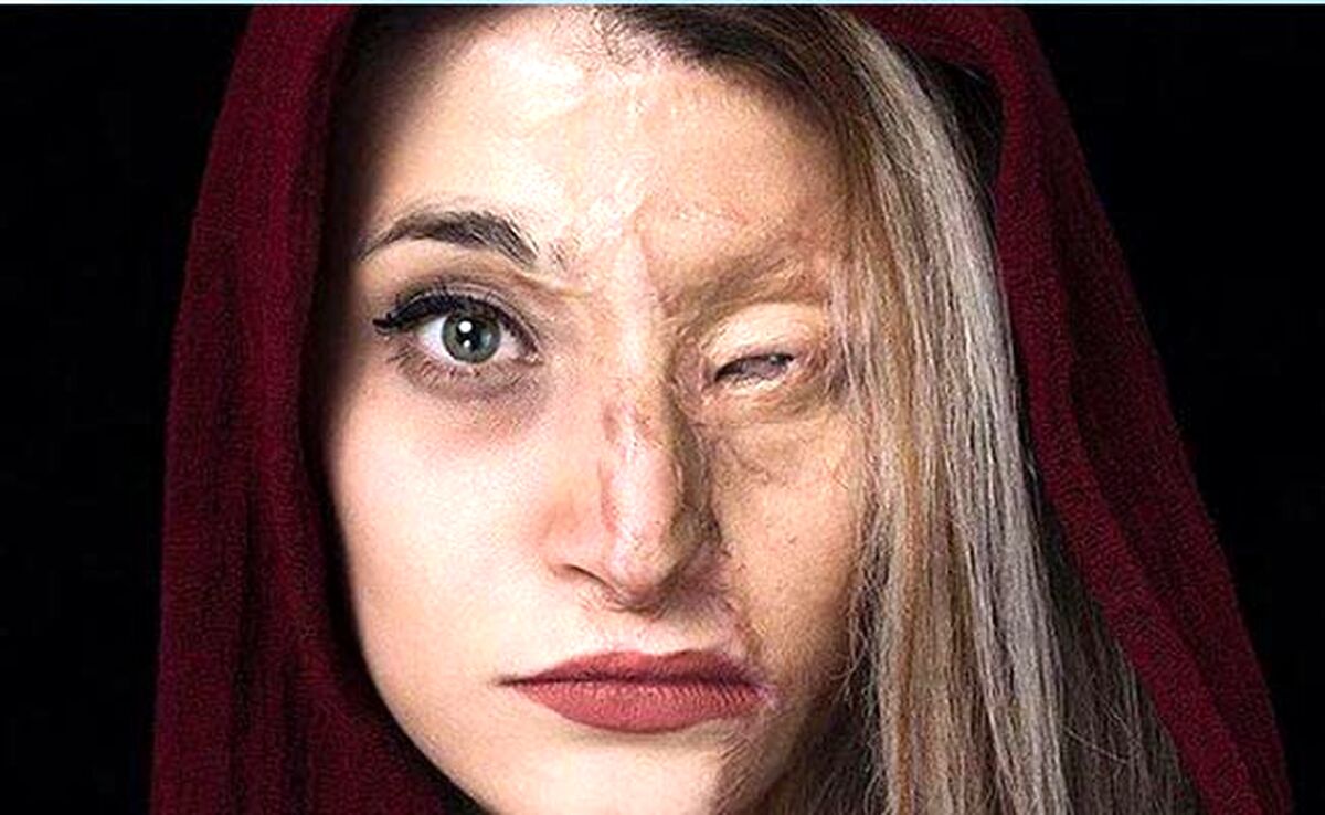 از لایحه منع خشونت علیه زنان چه خبر‌؟

