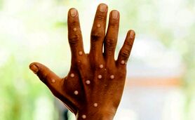 ​آنچه باید از کووید می‌آموختیم

